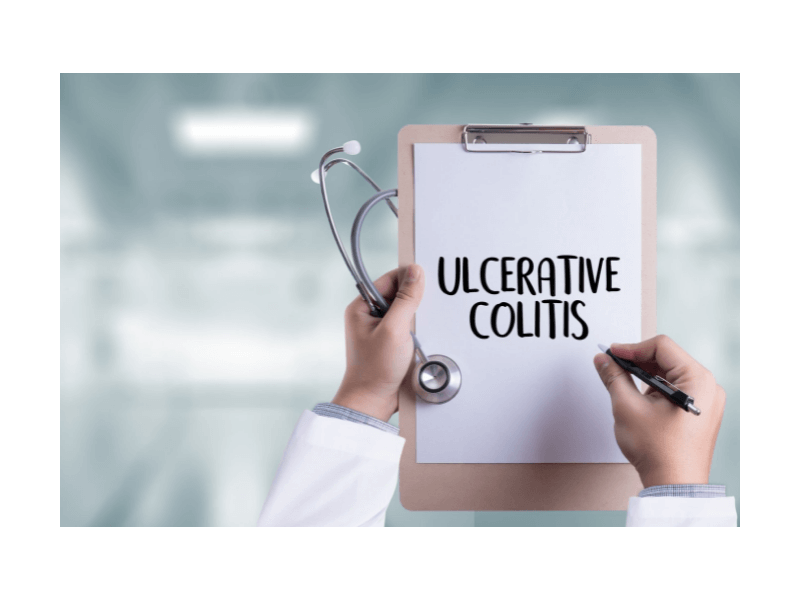 What Are the Signs of Ulcerative Colitis Remission?