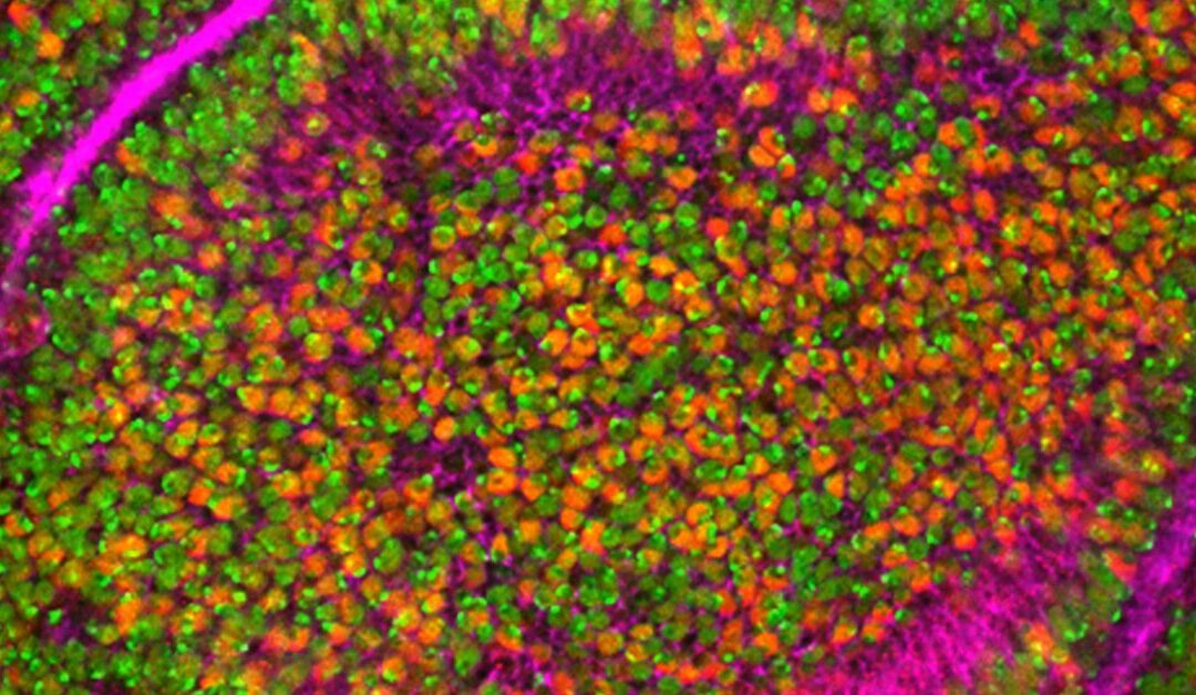 Probiotics for Crohn’s Disease