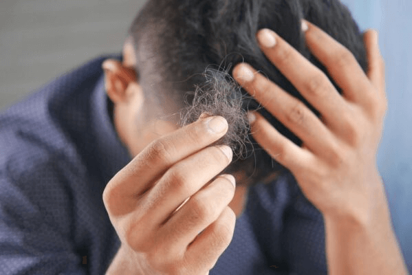 Hair Loss and IBD: Understanding the Link and Taking Action
