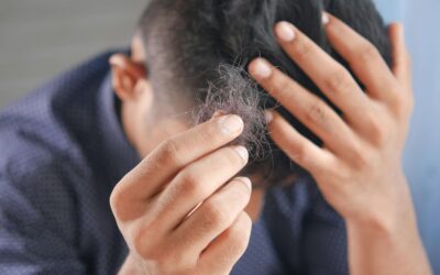 Hair Loss and IBD: Understanding the Link and Taking Action