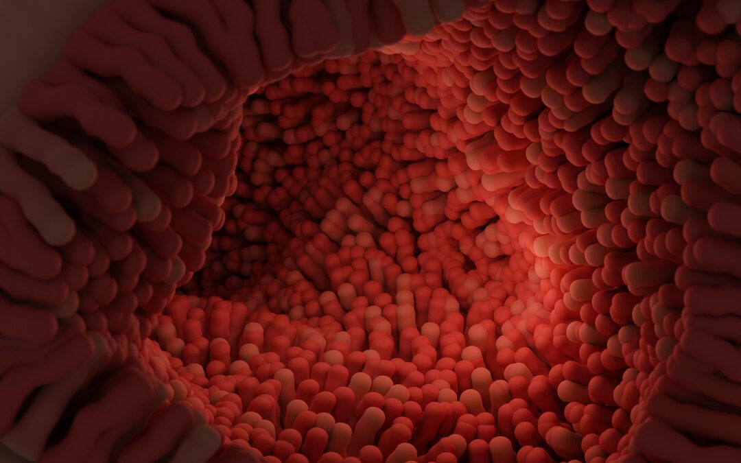 Treatment for Microscopic Colitis