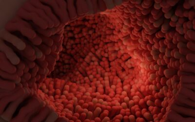 Treatment for Microscopic Colitis